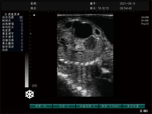 超声界面-1.jpg